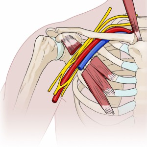 Desfiladero costoclavicular