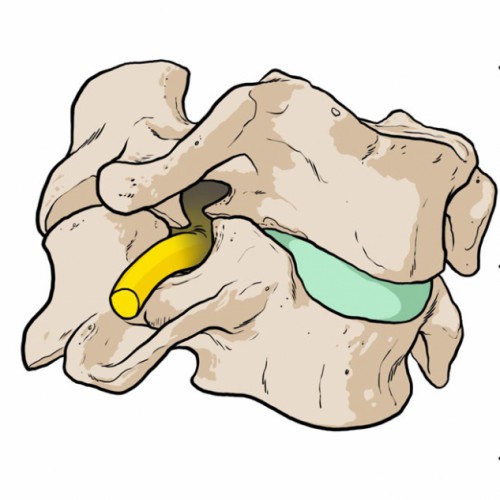 2016-04-UNIVERSIDAD-SEVILLA-FISIOTERAPIA---ENCARGO-1-VERTEBRAS---imagen-12